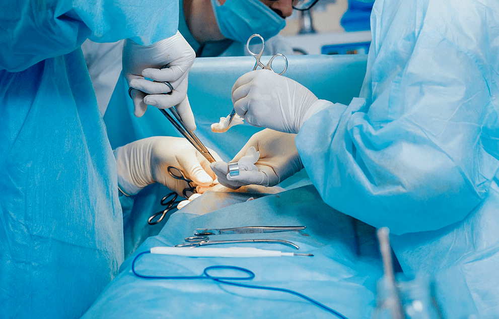 chirurgická metoda zvětšení penisu